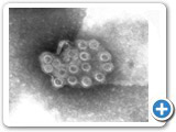 Imagem microscpica do vrus da dengue - Monika Barth/IOC