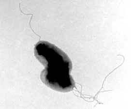 Bartonella sp